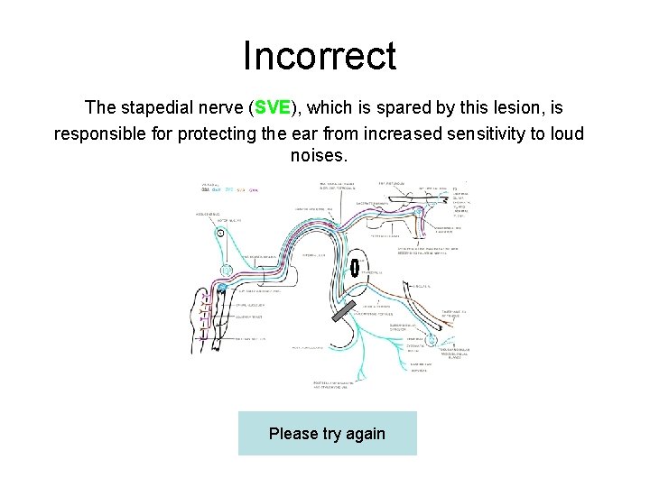 Incorrect The stapedial nerve (SVE), which is spared by this lesion, is responsible for