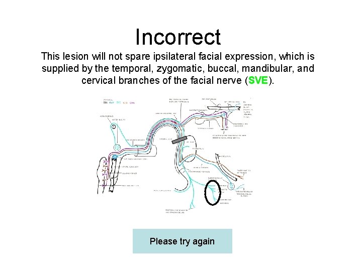 Incorrect This lesion will not spare ipsilateral facial expression, which is supplied by the
