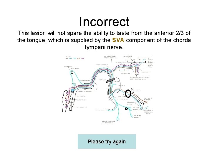 Incorrect This lesion will not spare the ability to taste from the anterior 2/3