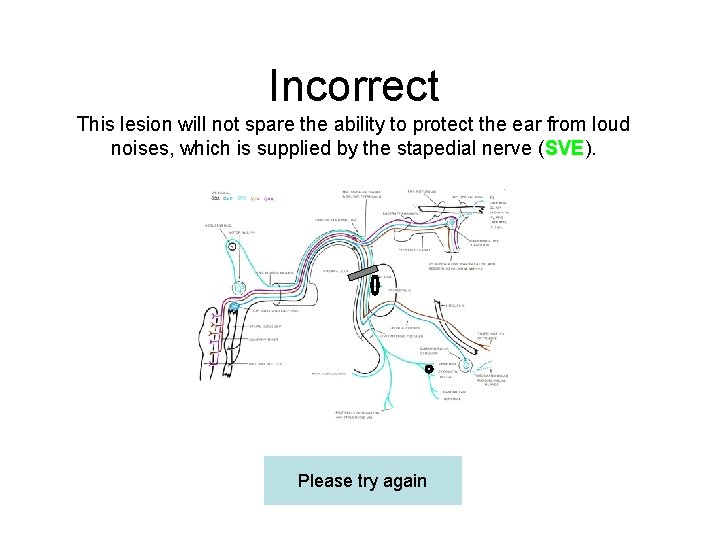 Incorrect This lesion will not spare the ability to protect the ear from loud