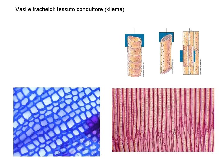 Vasi e tracheidi: tessuto conduttore (xilema) 