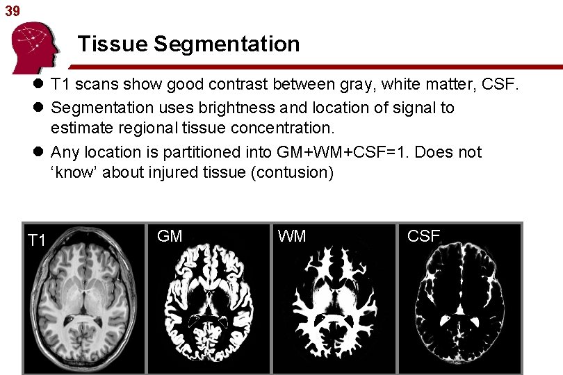 39 Tissue Segmentation l T 1 scans show good contrast between gray, white matter,