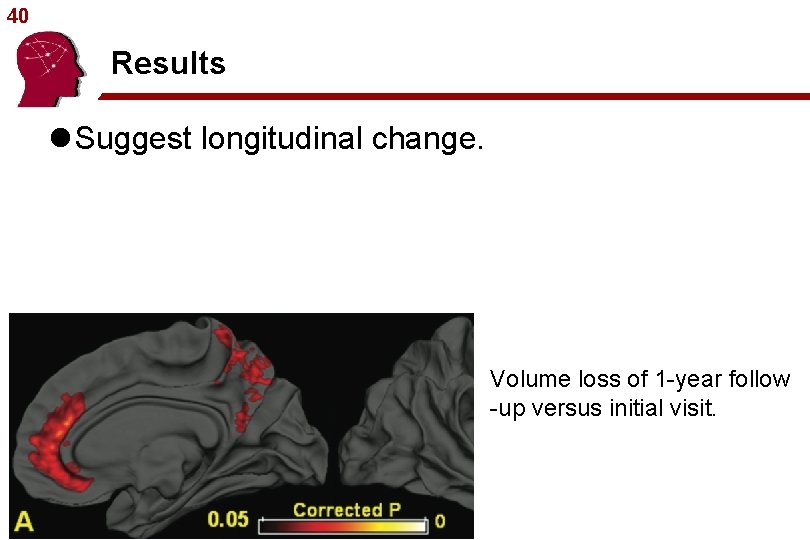 40 Results l Suggest longitudinal change. Volume loss of 1 -year follow -up versus