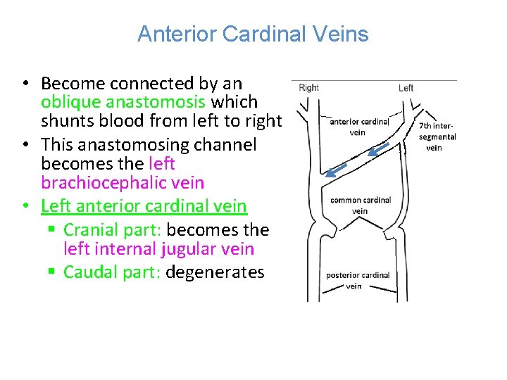 Anterior Cardinal Veins • Become connected by an oblique anastomosis which shunts blood from