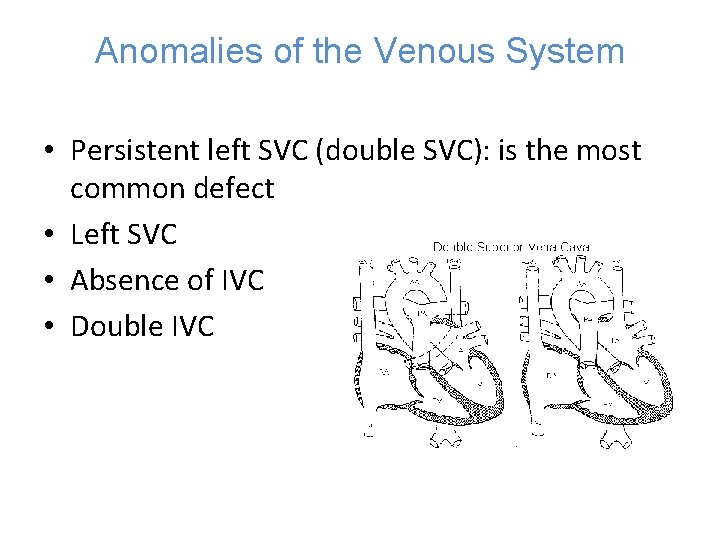 Anomalies of the Venous System • Persistent left SVC (double SVC): is the most
