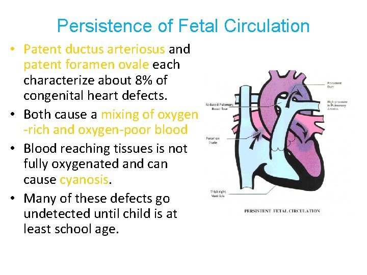 Persistence of Fetal Circulation • Patent ductus arteriosus and patent foramen ovale each characterize