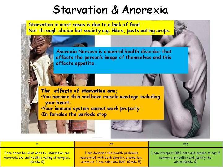 Starvation & Anorexia Starvation in most cases is due to a lack of food