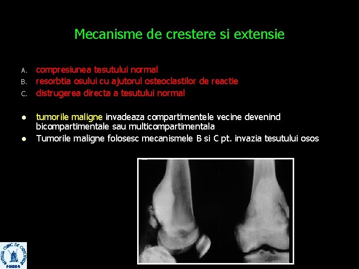 Mecanisme de crestere si extensie A. B. C. l l compresiunea tesutului normal resorbtia