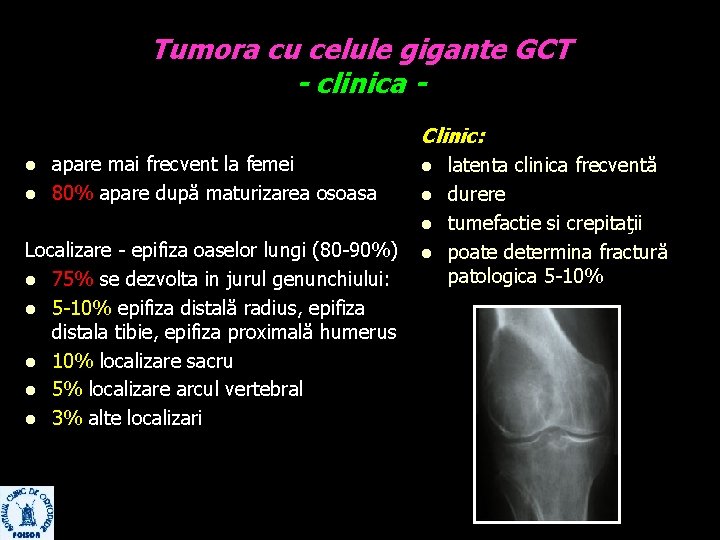 Tumora cu celule gigante GCT - clinica Clinic: l l apare mai frecvent la