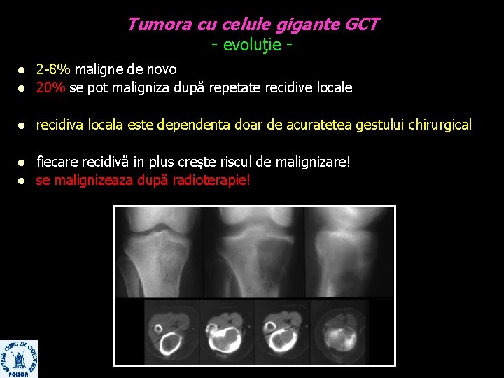 Tumora cu celule gigante GCT - evoluţie - l 2 -8% maligne de novo