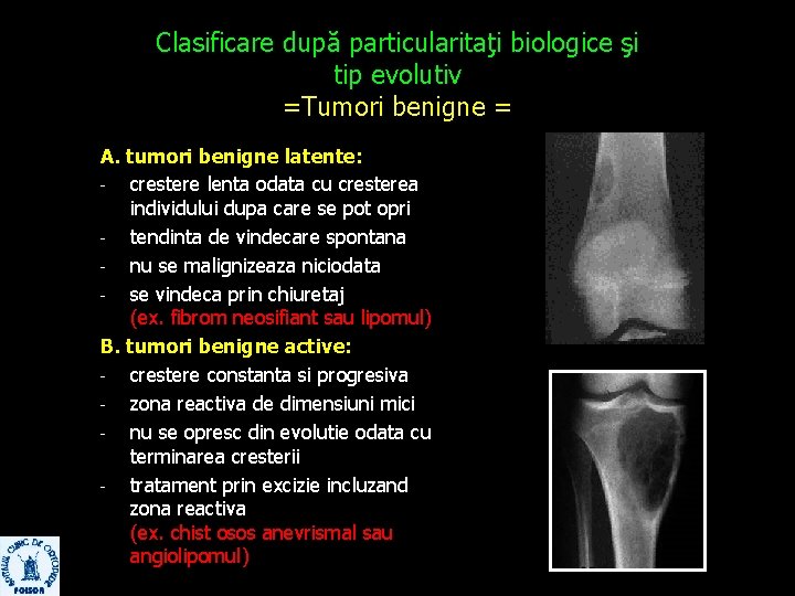 Clasificare după particularitaţi biologice şi tip evolutiv =Tumori benigne = A. tumori benigne latente: