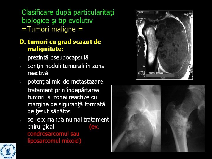 Clasificare după particularitaţi biologice şi tip evolutiv =Tumori maligne = D. tumori cu grad