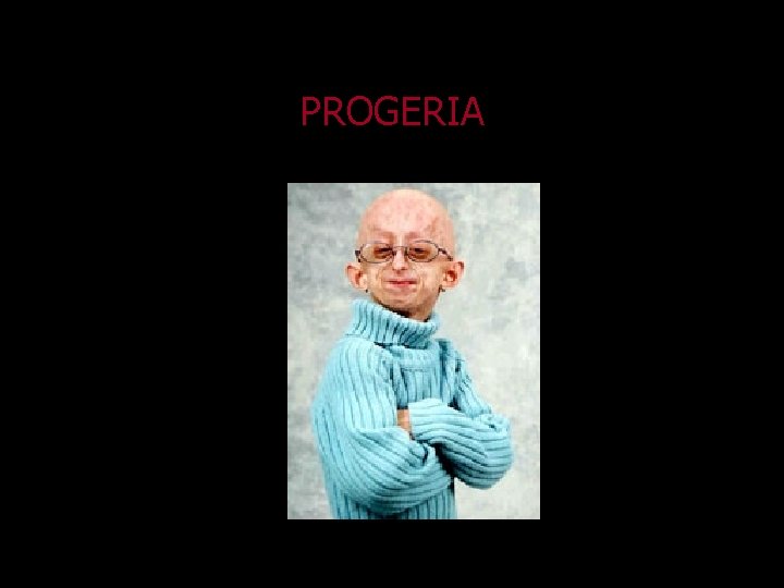 PROGERIA 