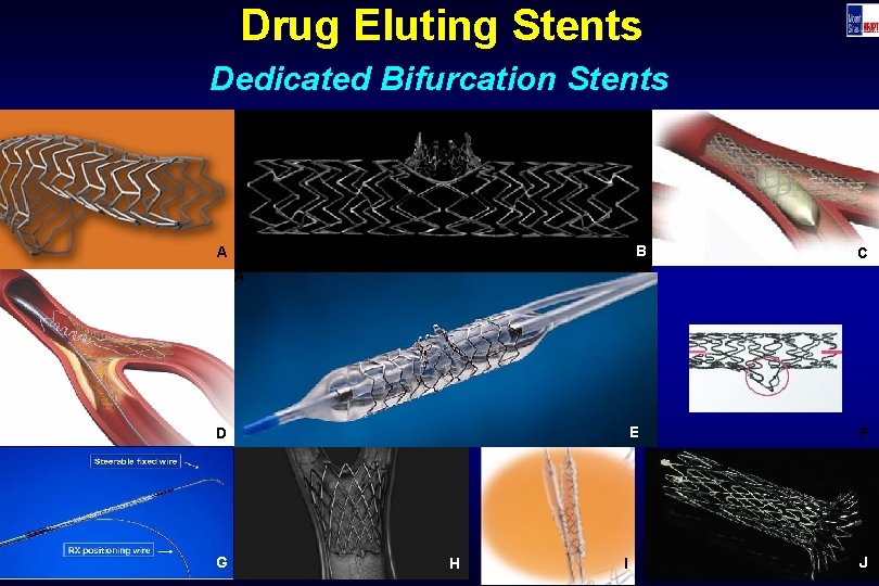 Drug Eluting Stents Dedicated Bifurcation Stents B A C A E D G H
