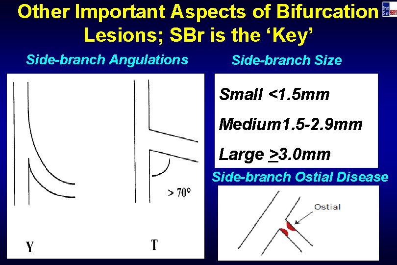 Other Important Aspects of Bifurcation Lesions; SBr is the ‘Key’ Side-branch Angulations Side-branch Size