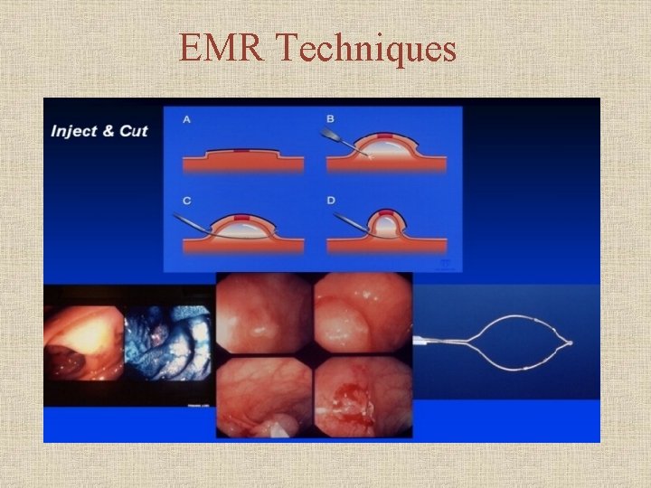 EMR Techniques 