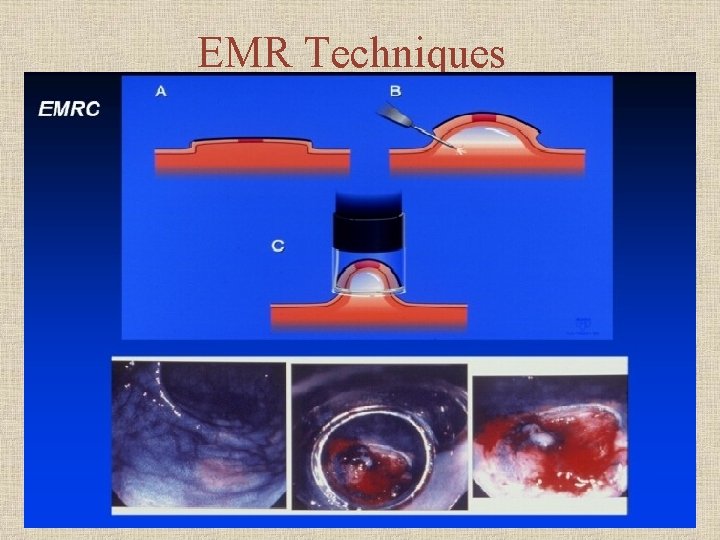 EMR Techniques 