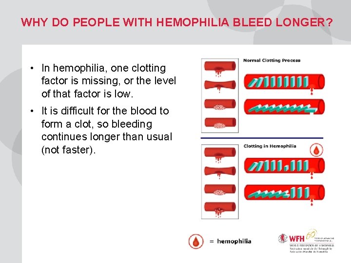 WHY DO PEOPLE WITH HEMOPHILIA BLEED LONGER? • In hemophilia, one clotting factor is