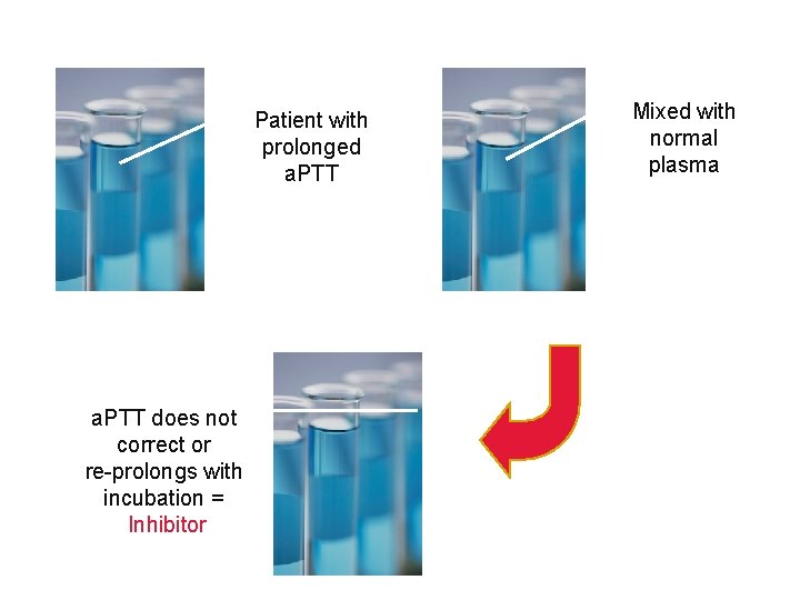 Patient with prolonged a. PTT + a. PTT does not correct or re-prolongs with