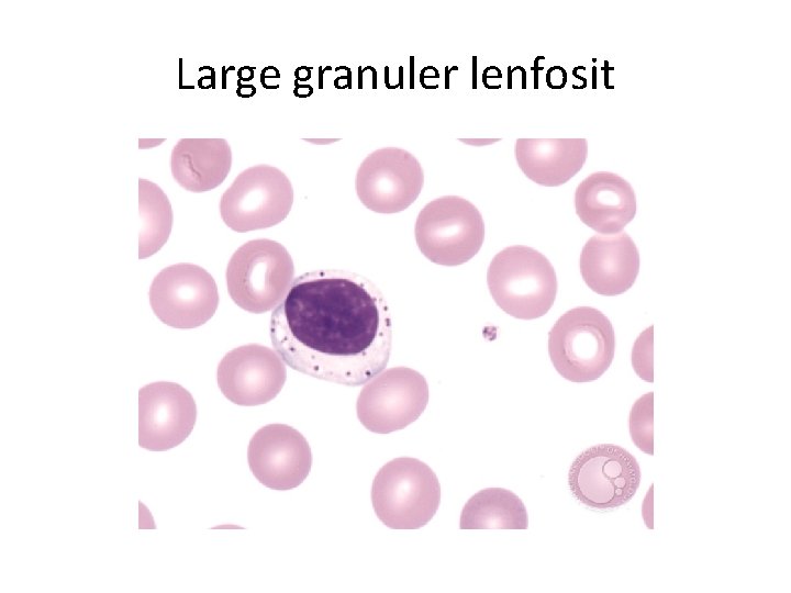 Large granuler lenfosit 