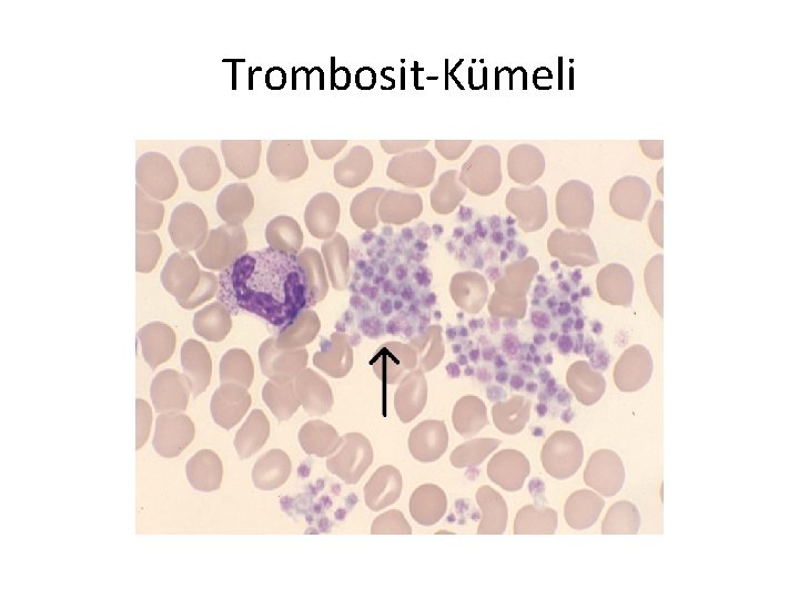 Trombosit-Kümeli 