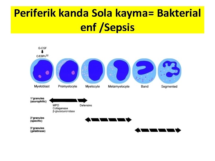 Periferik kanda Sola kayma= Bakterial enf /Sepsis 