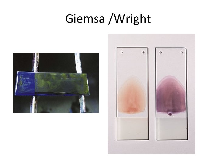 Giemsa /Wright 