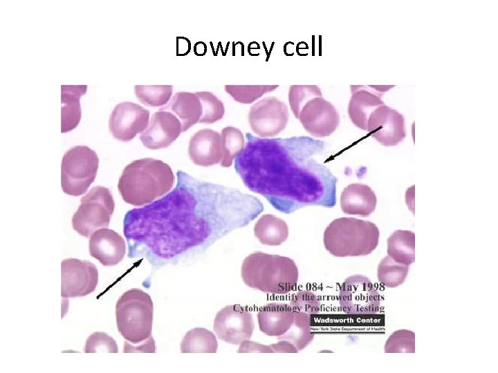 Downey cell 