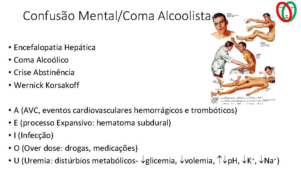 Confusão Mental/Coma Alcoolista Básico • Encefalopatia Hepática • Coma Alcoólico • Crise Abstinência •
