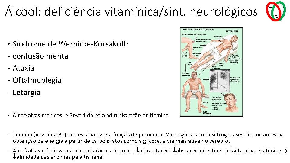 Álcool: deficiência vitamínica/sint. neurológicos Básico Clínic o MSP 4211 • Síndrome de Wernicke-Korsakoff: -