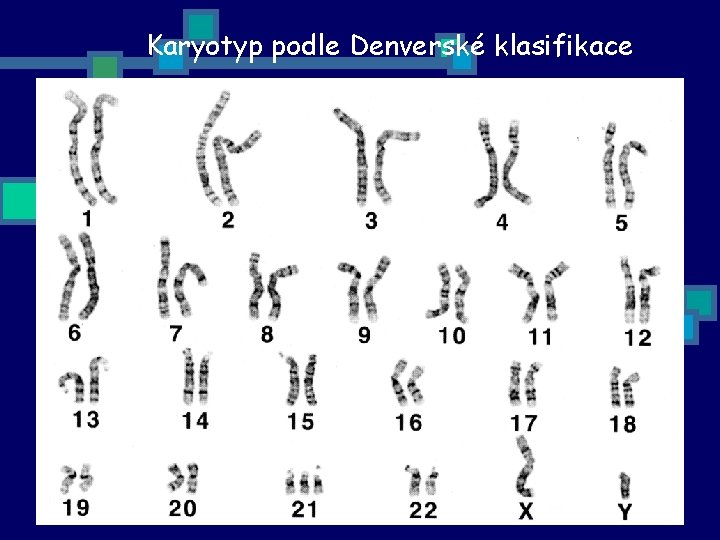 Karyotyp podle Denverské klasifikace 