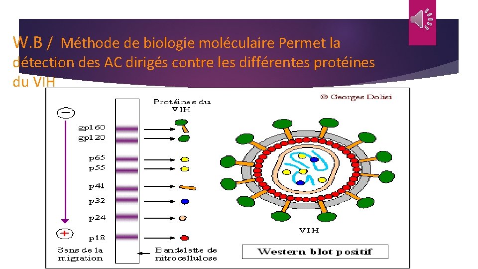 W. B / Méthode de biologie moléculaire Permet la détection des AC dirigés contre