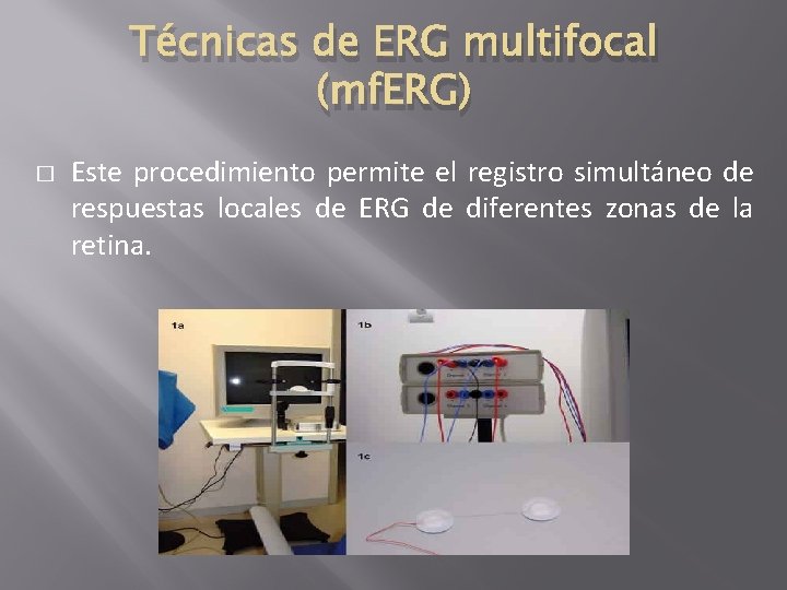 Técnicas de ERG multifocal (mf. ERG) � Este procedimiento permite el registro simultáneo de