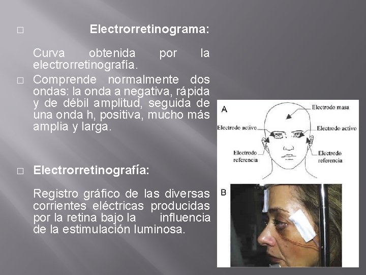 � � � Electrorretinograma: Curva obtenida por la electrorretinografía. Comprende normalmente dos ondas: la