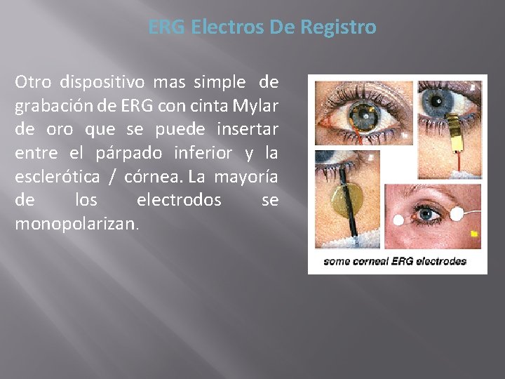 ERG Electros De Registro Otro dispositivo mas simple de grabación de ERG con cinta