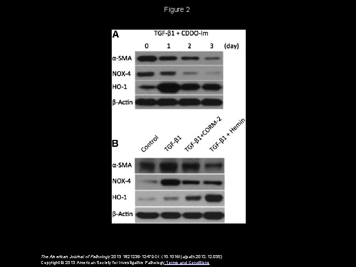 Figure 2 The American Journal of Pathology 2013 1821239 -1247 DOI: (10. 1016/j. ajpath.