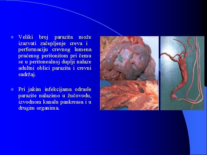 l Veliki broj parazita može izazvati začepljenje creva i performaciju crevnog lumena praćenog peritonitom