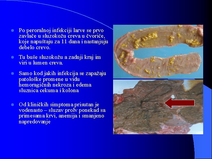 l Po peroralnoj infekciji larve se prvo zavlače u sluzokožu creva u čvoriće, koje