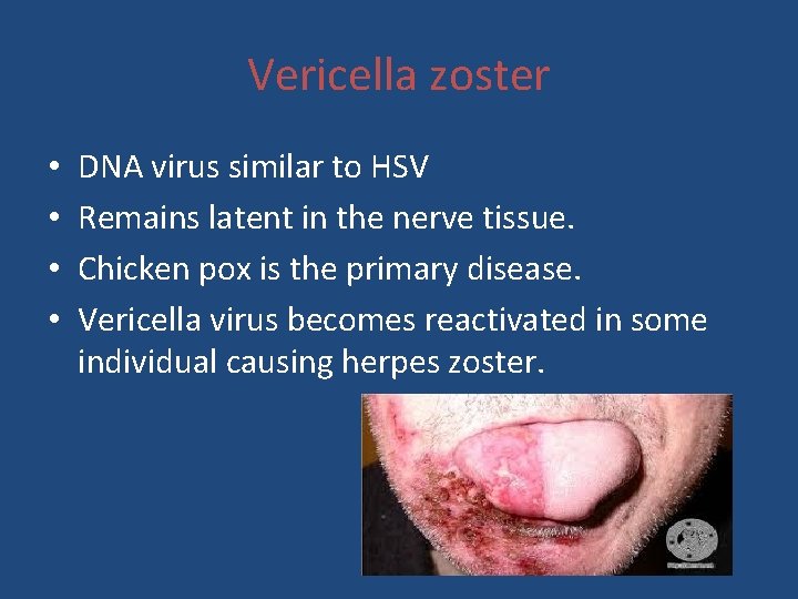 Vericella zoster • • DNA virus similar to HSV Remains latent in the nerve