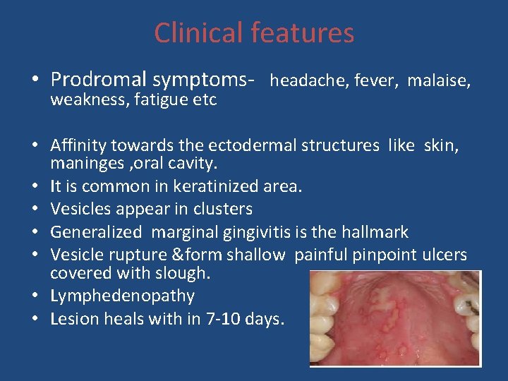 Clinical features • Prodromal symptoms- headache, fever, malaise, weakness, fatigue etc • Affinity towards