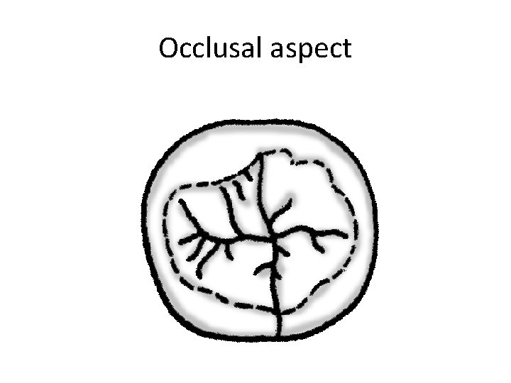 Occlusal aspect 
