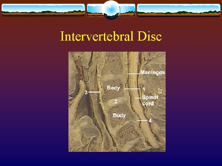 Intervertebral Disc Intervertebral Disc