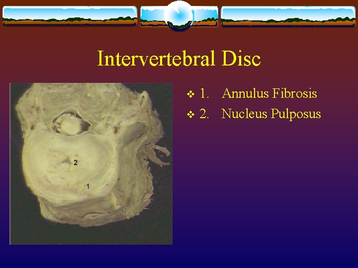 Intervertebral Disc 1. Annulus Fibrosis v 2. Nucleus Pulposus v 