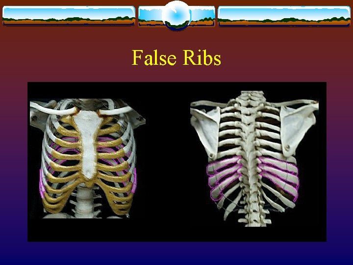 False Ribs False Ribs
