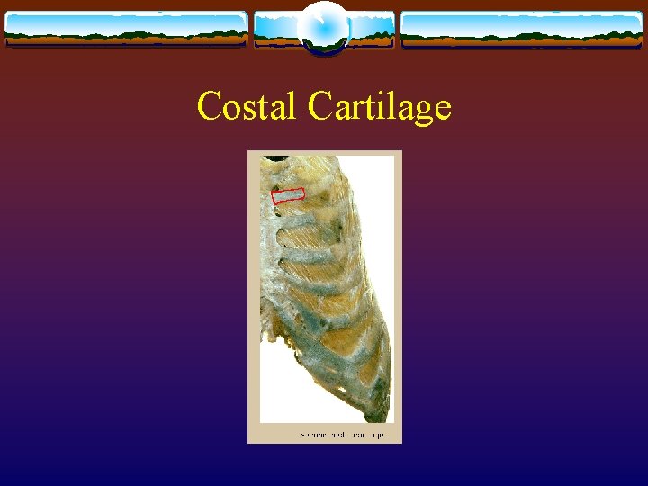 Costal Cartilage Costal Cartilage