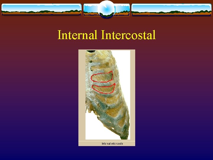 Internal Intercostal Internal Intercostal