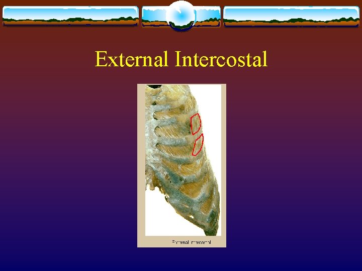 External Intercostal 