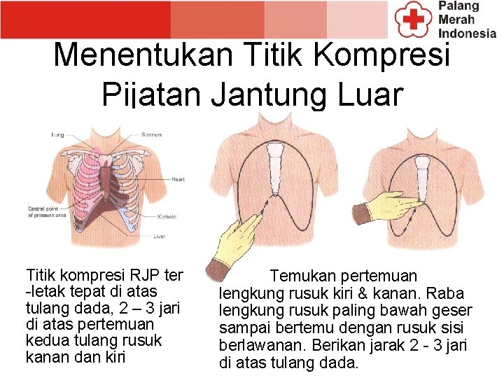 Menentukan Titik Kompresi Pijatan Jantung Luar Titik kompresi RJP ter -letak tepat di atas