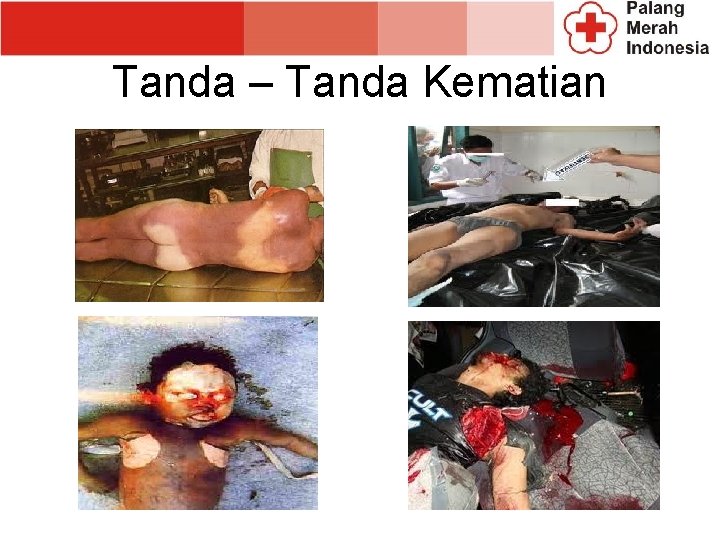 Tanda – Tanda Kematian 