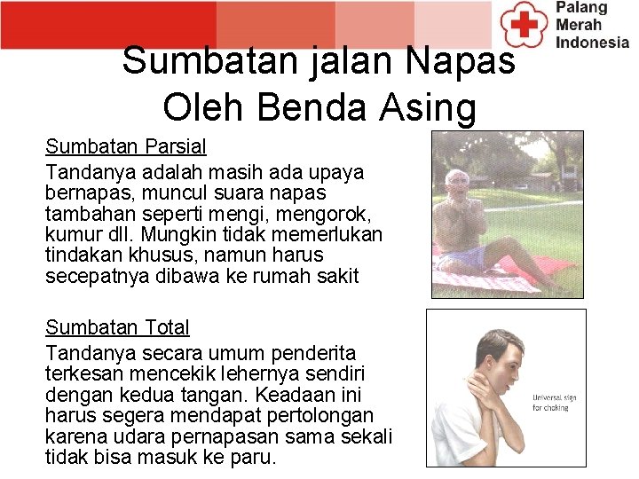 Sumbatan jalan Napas Oleh Benda Asing Sumbatan Parsial Tandanya adalah masih ada upaya bernapas,